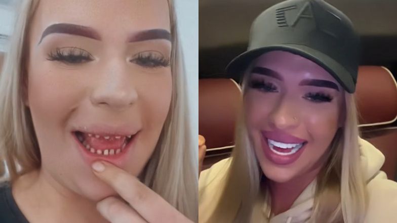 Polka wydała małą fortunę na "tureckie zęby". Pochwaliła się metamorfozą. Było warto? (WIDEO)