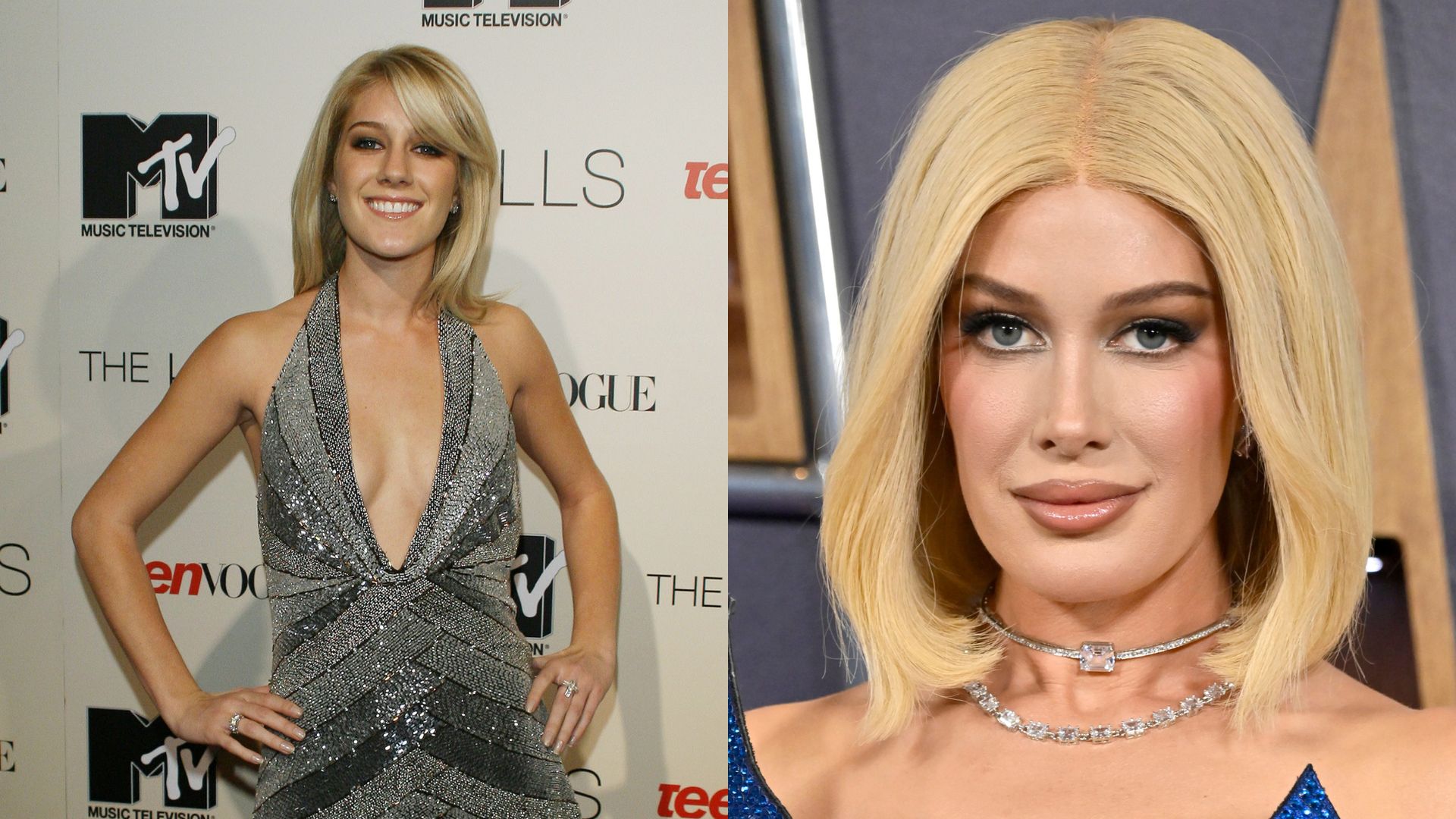 Heidi Montag przeszła 10 OPERACJI PLASTYCZNYCH jednego dnia. Po latach przyznała, iż żałuje: "Urżnęli mi kawał brody. Ledwo mówiłam"