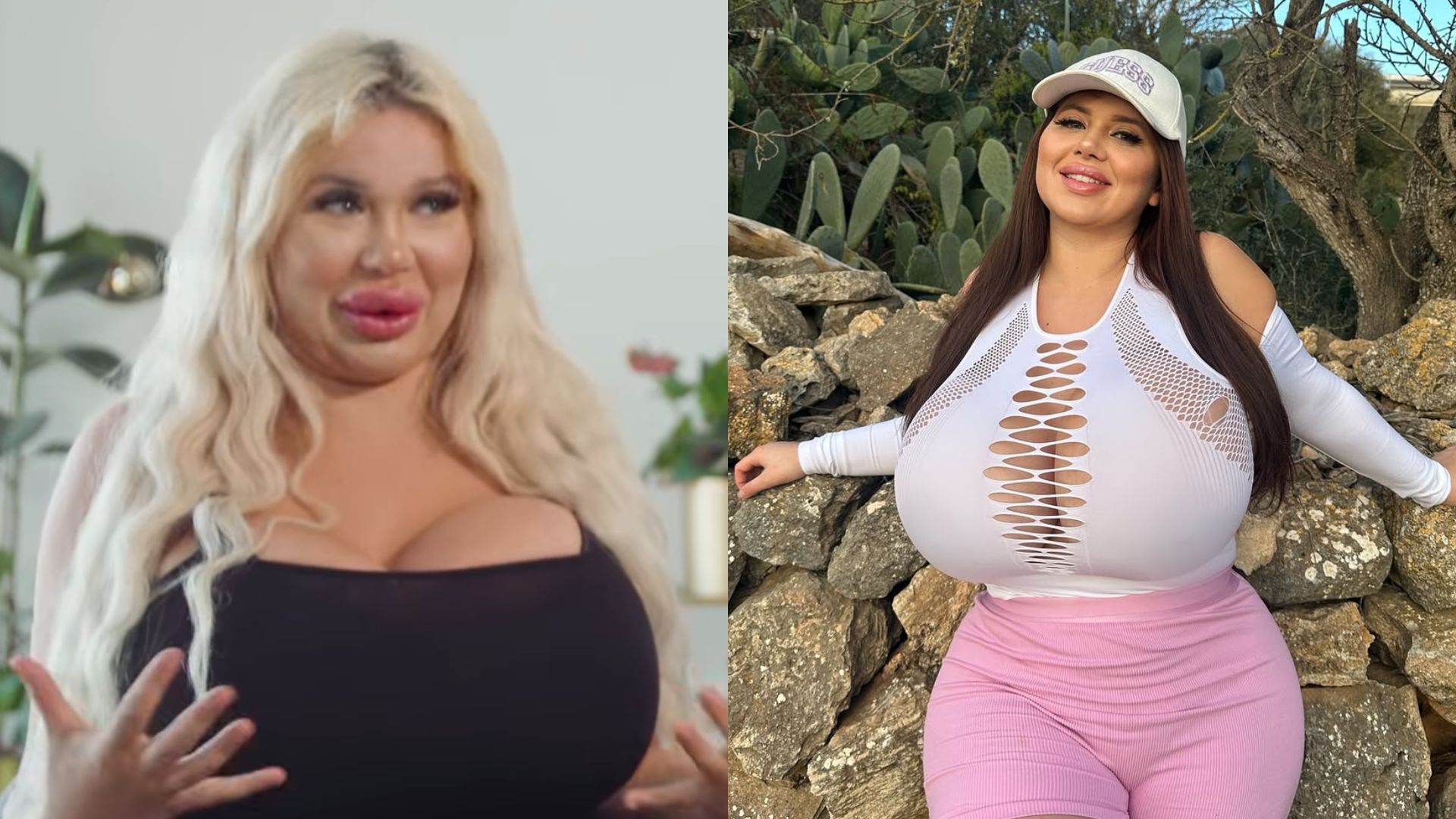 Wydała FORTUNĘ na operacje plastyczne i wypełniacze: "Uwielbiam być plastikowa". Na zdjęciu "przed" jej nie rozpoznacie