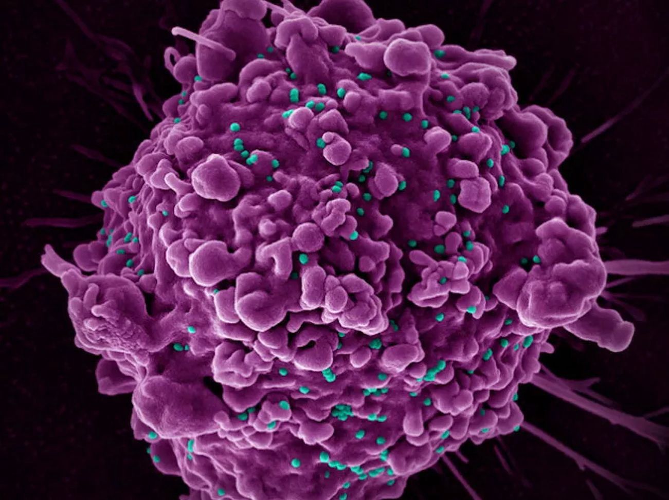 Mutacja zapewniająca odporność na HIV. Powstała kilka tysięcy lat temu