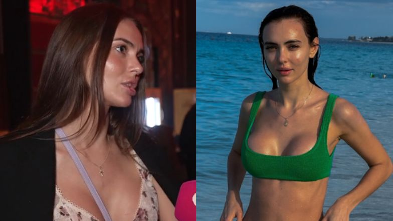 Marcela Leszczak o operacjach plastycznych: "Miałam za duże usta. To wymknęło się spod kontroli". Ujawnia, co jeszcze sobie poprawiła