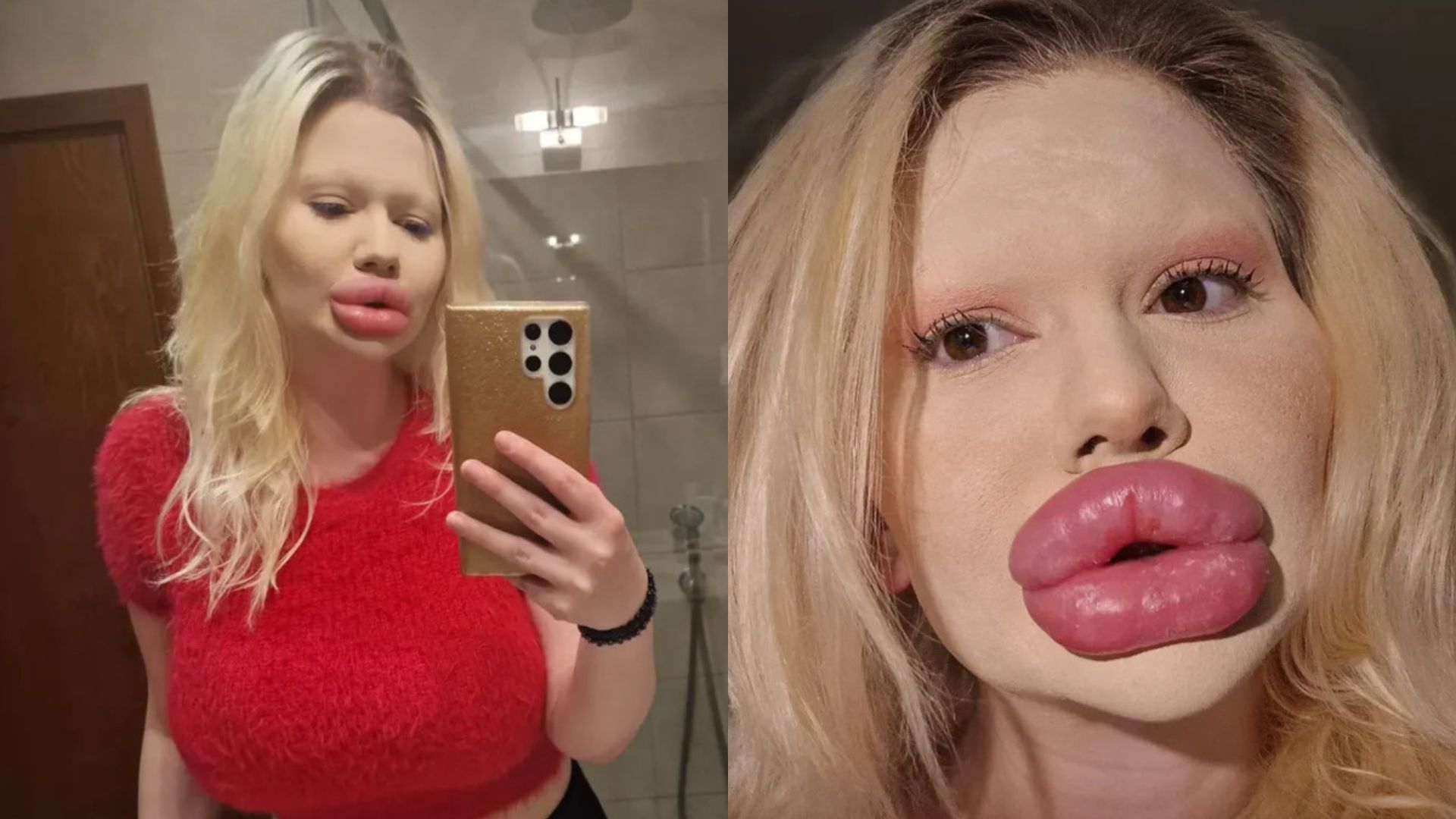 Zapragnęła mieć NAJWIĘKSZE USTA NA ŚWIECIE. "Bułgarska Barbie" przeszła szokującą metamorfozę. Nie uwierzycie, jak wyglądała wcześniej