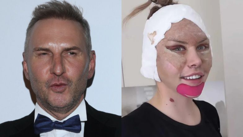 29-letnia Julia von Stein prezentuje efekty liftingu CAŁEJ TWARZY, a Krzysztof Gojdź grzmi: "TO NIEPOROZUMIENIE"