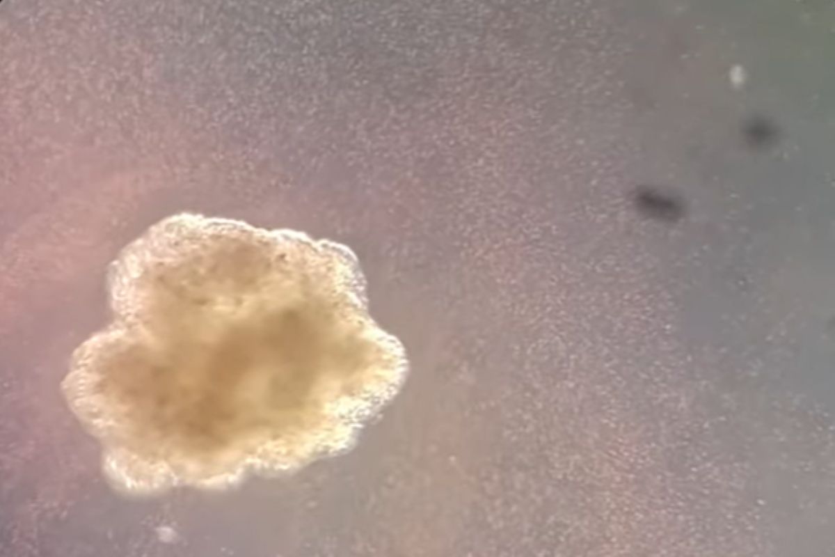 "Trzeci stan istnienia". Komórki martwych organizmów mogą się przekształcać