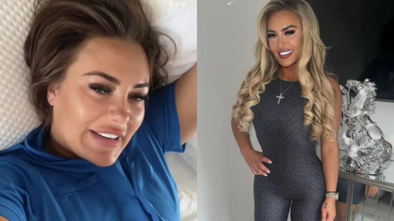 Tiktokerka zrobiła w Turcji SZEŚĆ OPERACJI PLASTYCZNYCH jednocześnie: "Byłam w agonii, myślałam, iż umrę"