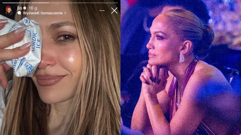 Jennifer Lopez miała WYPADEK na próbie i rozwaliła sobie nos