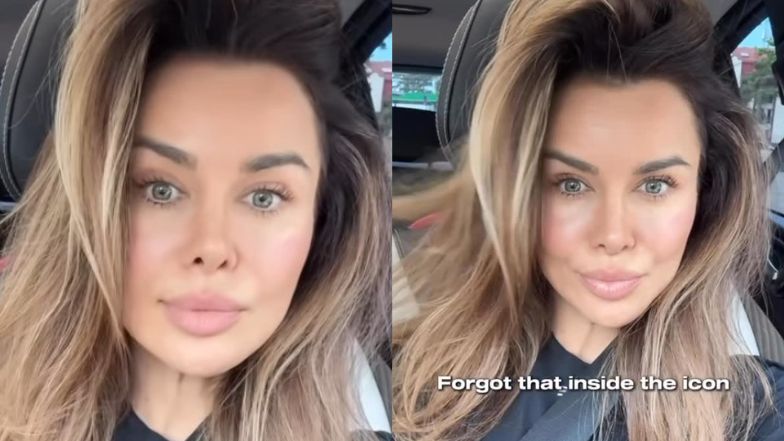 Natalia Siwiec pokazała zdjęcia z młodości. Tak wyglądała zanim zaczęła korzystać z medycyny estetycznej. Bardzo się zmieniła?