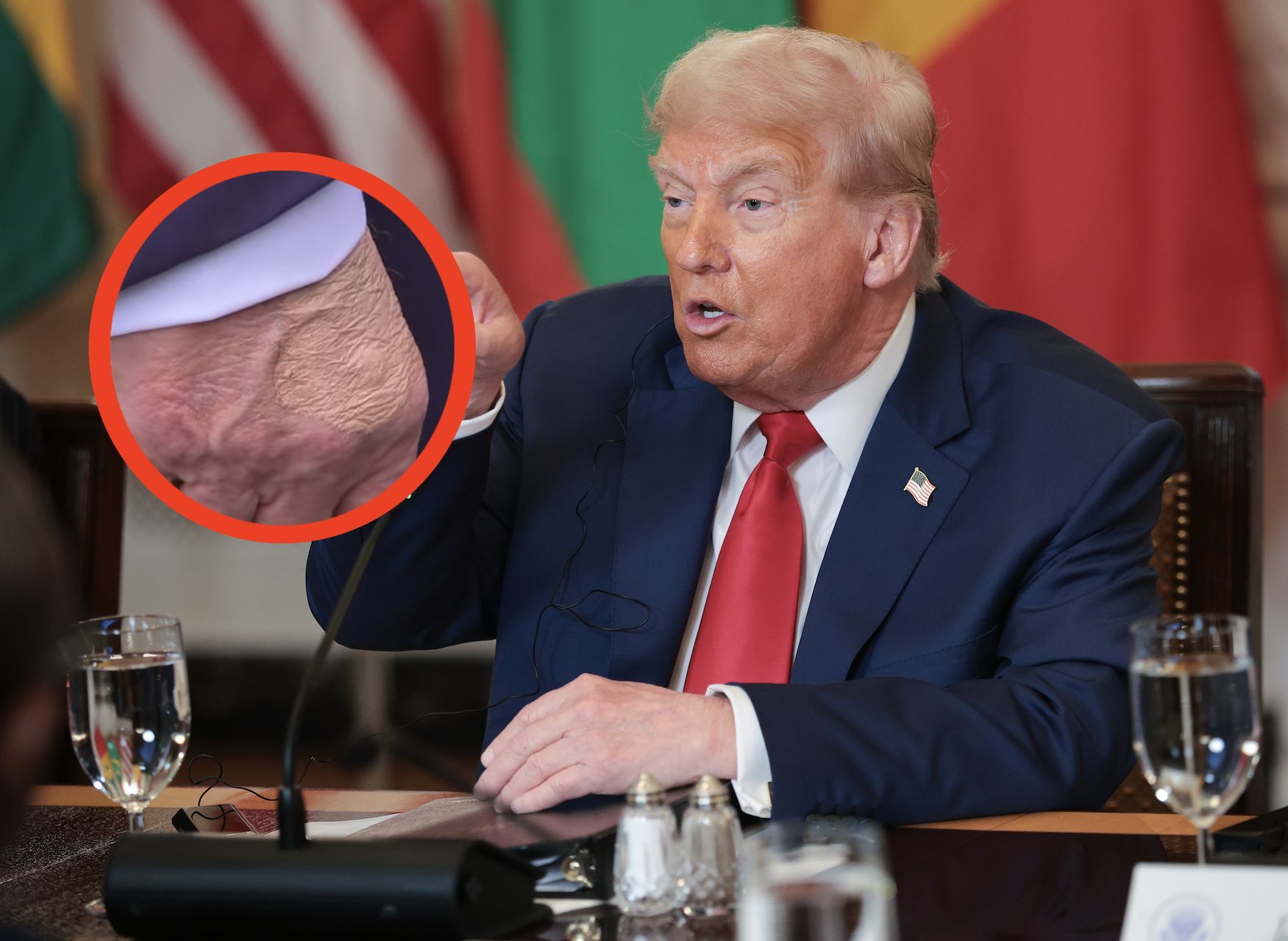 Ręka Donalda Trumpa. Uwagę przyciągnął tajemniczy ślad