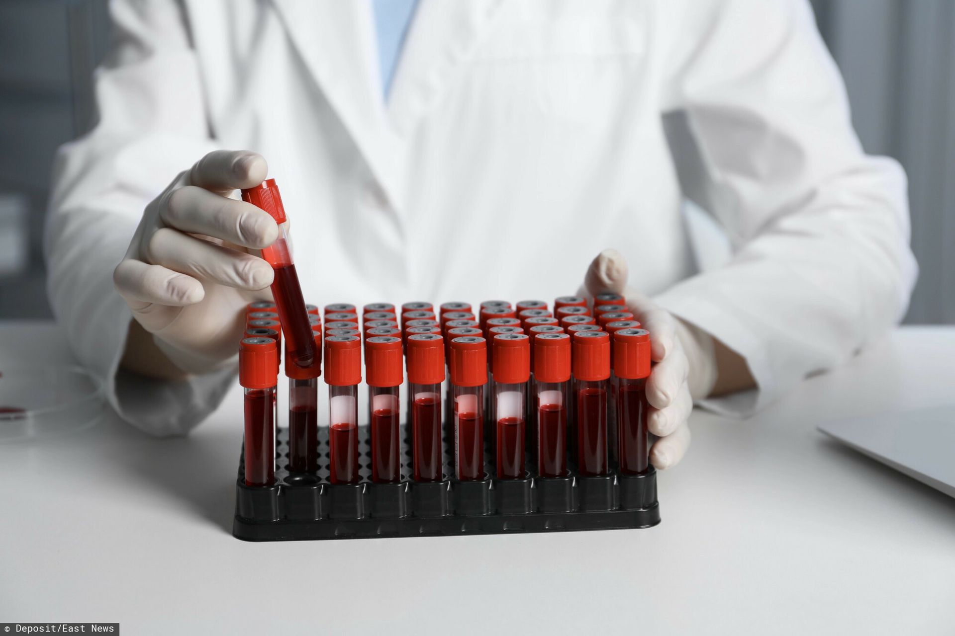 Odkryli nową grupę krwi. Tylko jedna osoba na świecie