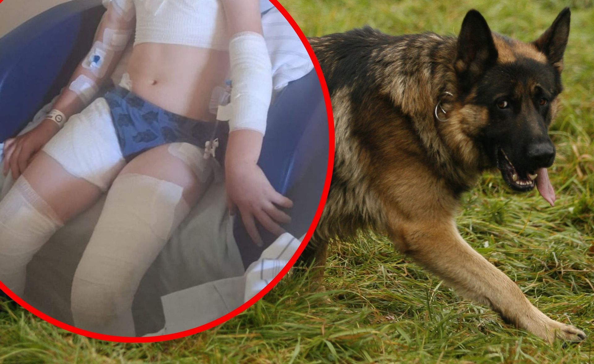Miłosza pogryzły psy. Rodzina prosi o pomoc dla chłopca