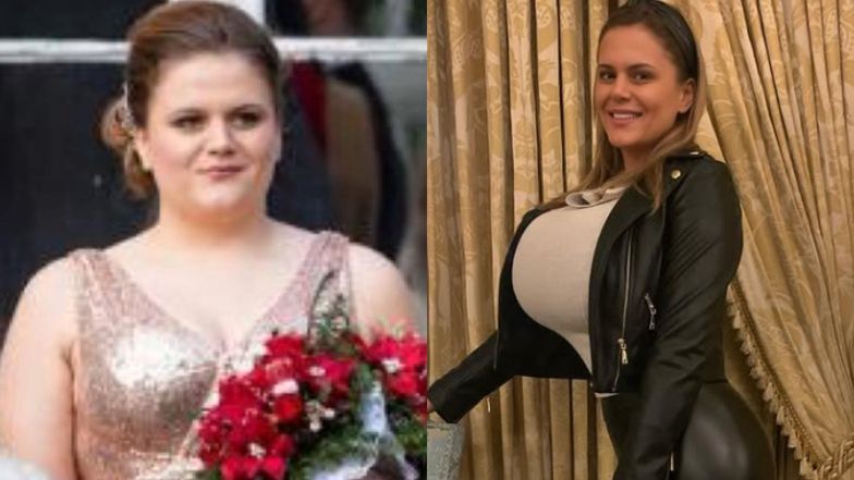 W szkole wyśmiewali się z jej wyglądu. Na swoją metamorfozę wydała 150 TYSIĘCY złotych