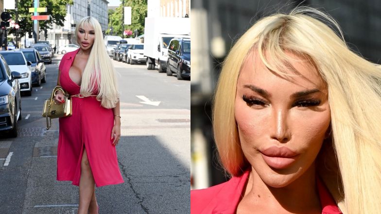 Jessica Alves prezentuje zmodyfikowane lico i świeci dekoltem na ulicach Londynu