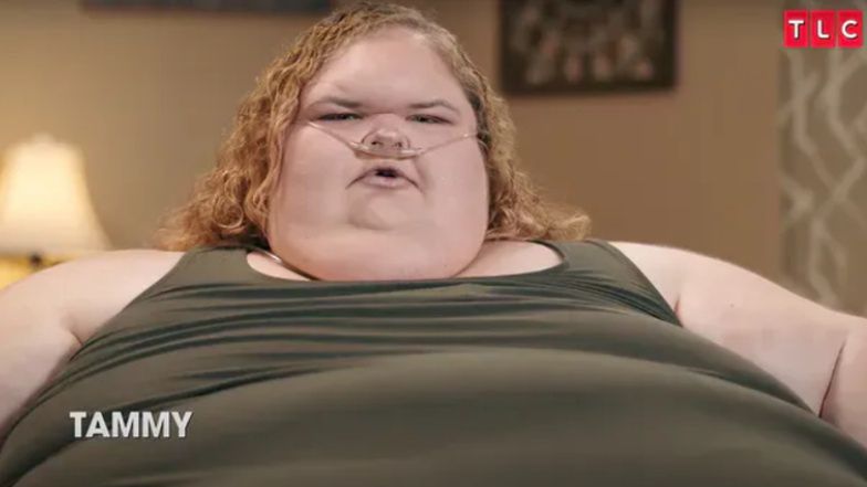 Tammy Slaton z "Sióstr wielkiej wagi" przeszła operację USUNIĘCIA SKÓRY! Tak teraz wygląda