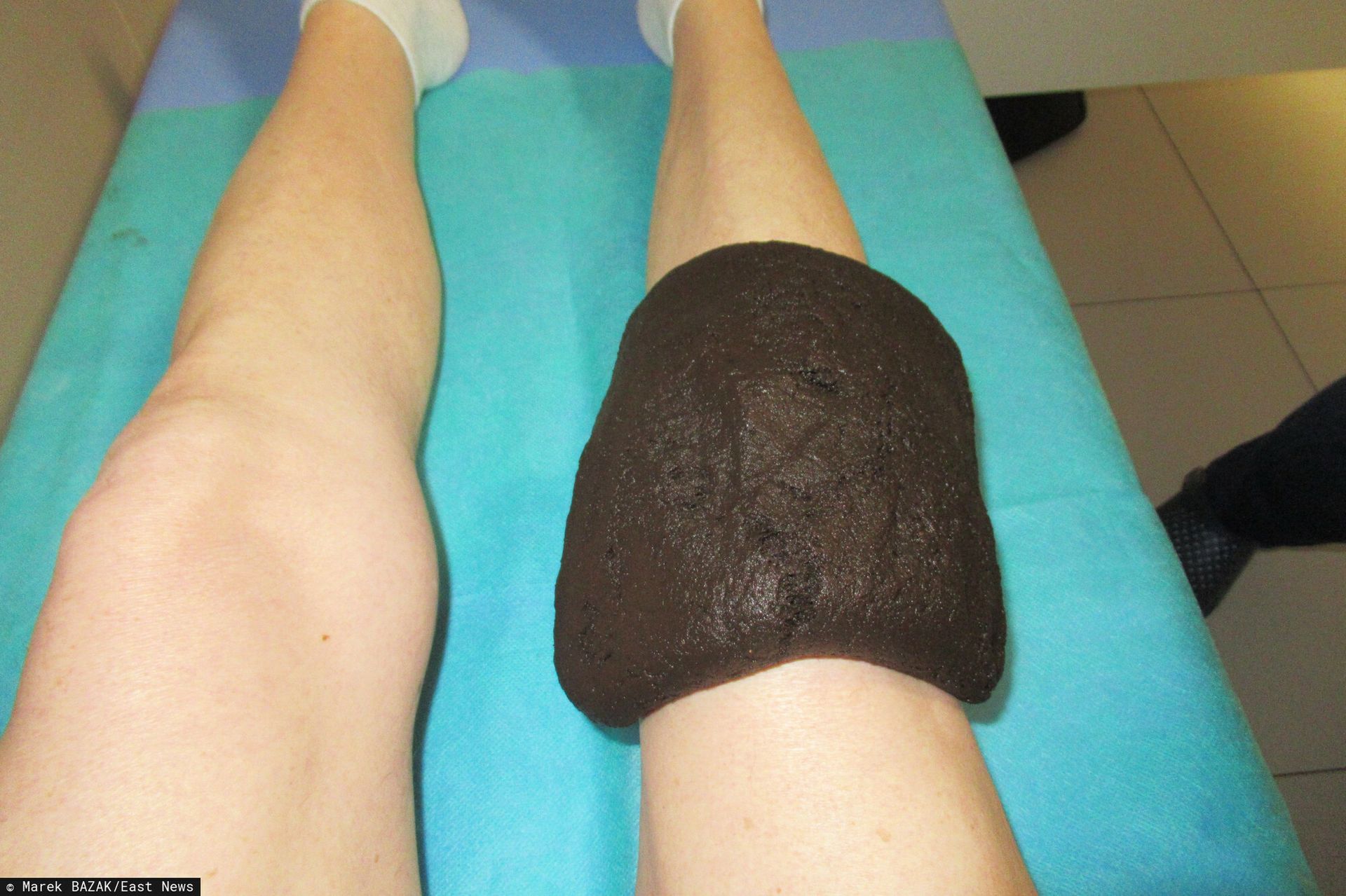 Trzy tygodnie leczenia uzdrowiskowego za darmo. Oto komu przysługuje