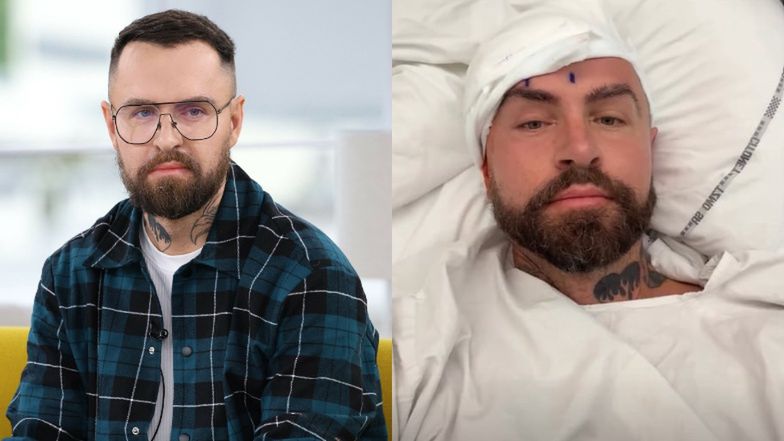 Łukasz Urbański przeszedł operację usunięcia guza mózgu. Fryzjer gwiazd pokazał zdjęcie po zabiegu