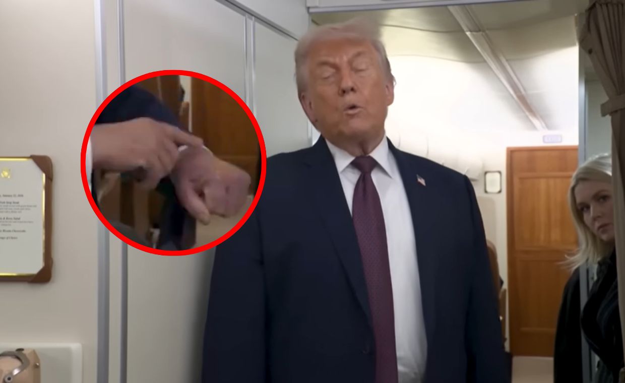 Trump o siniaku na dłoni. Wskazał na wydarzenia w Davos