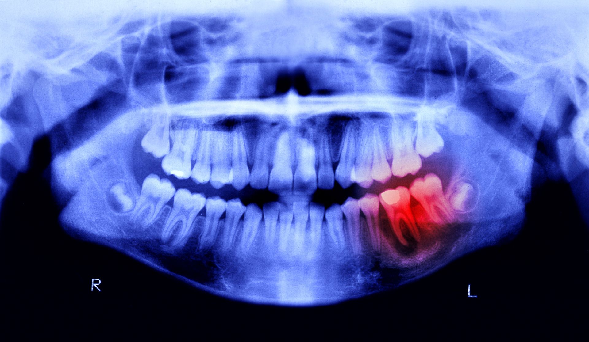 Robot zastąpi dentystę? Chińczycy opracowali niezwykłą technologię