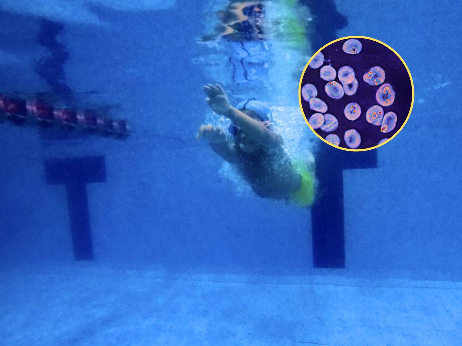 "Zjada mózg".To wyjatkow niebezpieczny mikrooorganizm