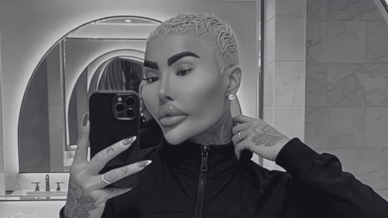 34-letni gwiazdor reality show nie żyje. Tuż przed śmiercią miał poddać się kolejnemu liftingowi pośladków