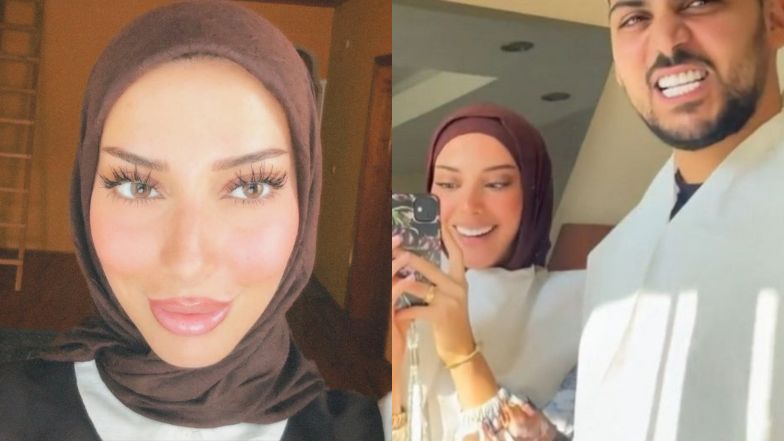 Para zafundowała sobie nowe zęby w Turcji. Internauci bezlitośnie: "Wyglądają jak błyszczący plastik"