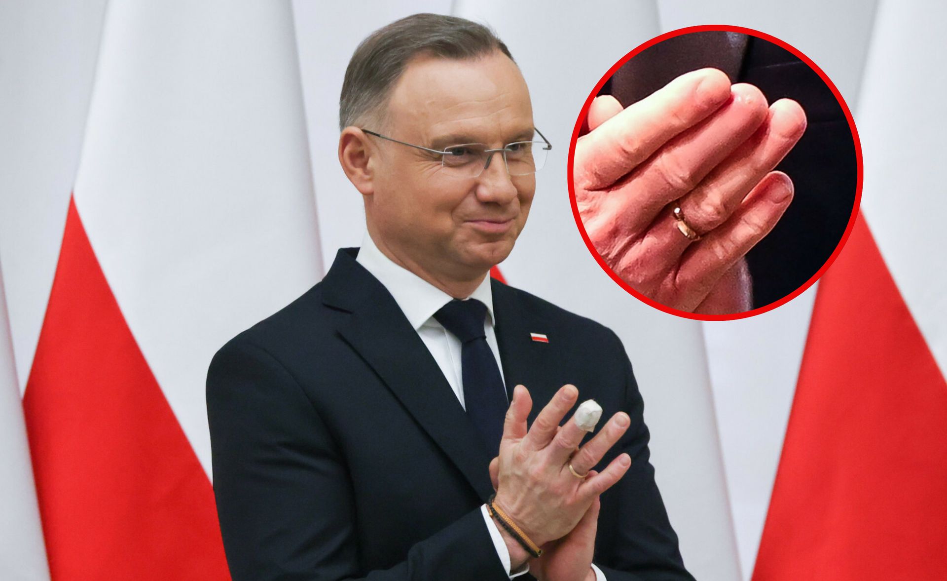 Kontuzja Dudy. Były prezydent ujawnia. "Do tej pory to była tajemnica"