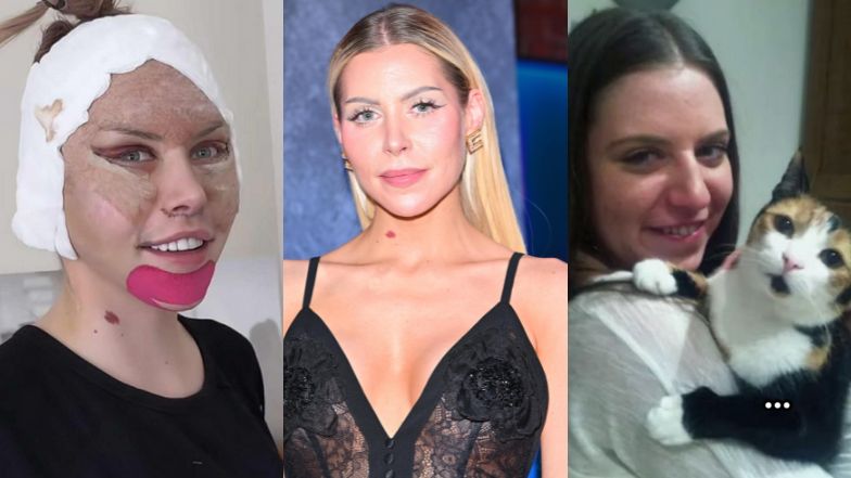 Julia von Stein zafundowała sobie lifting twarzy. Pamiętacie, jak KIEDYŚ wyglądała?