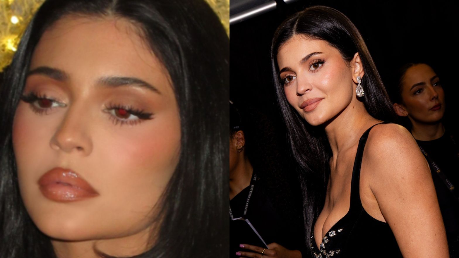 Kylie Jenner rozpuściła usta? "Wyglądają NORMALNIE" (FOTO)