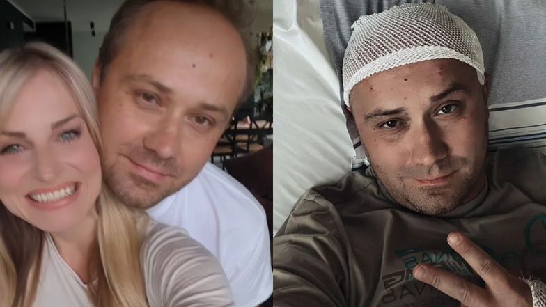 Anita ze "ŚOPW" wspiera męża po operacji usunięcia GUZA MÓZGU: "Nie traci nadziei, jest taki silny"