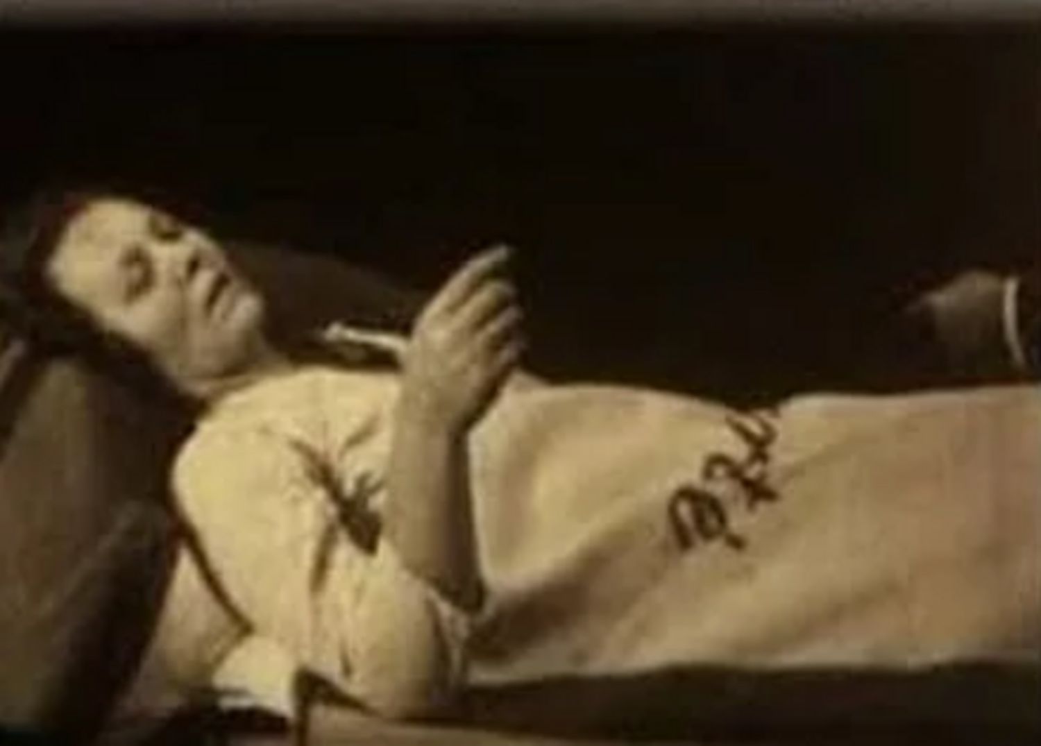 Tajemnicza choroba sprzed wieku. Zabiła 500 tys. osób i zniknęła