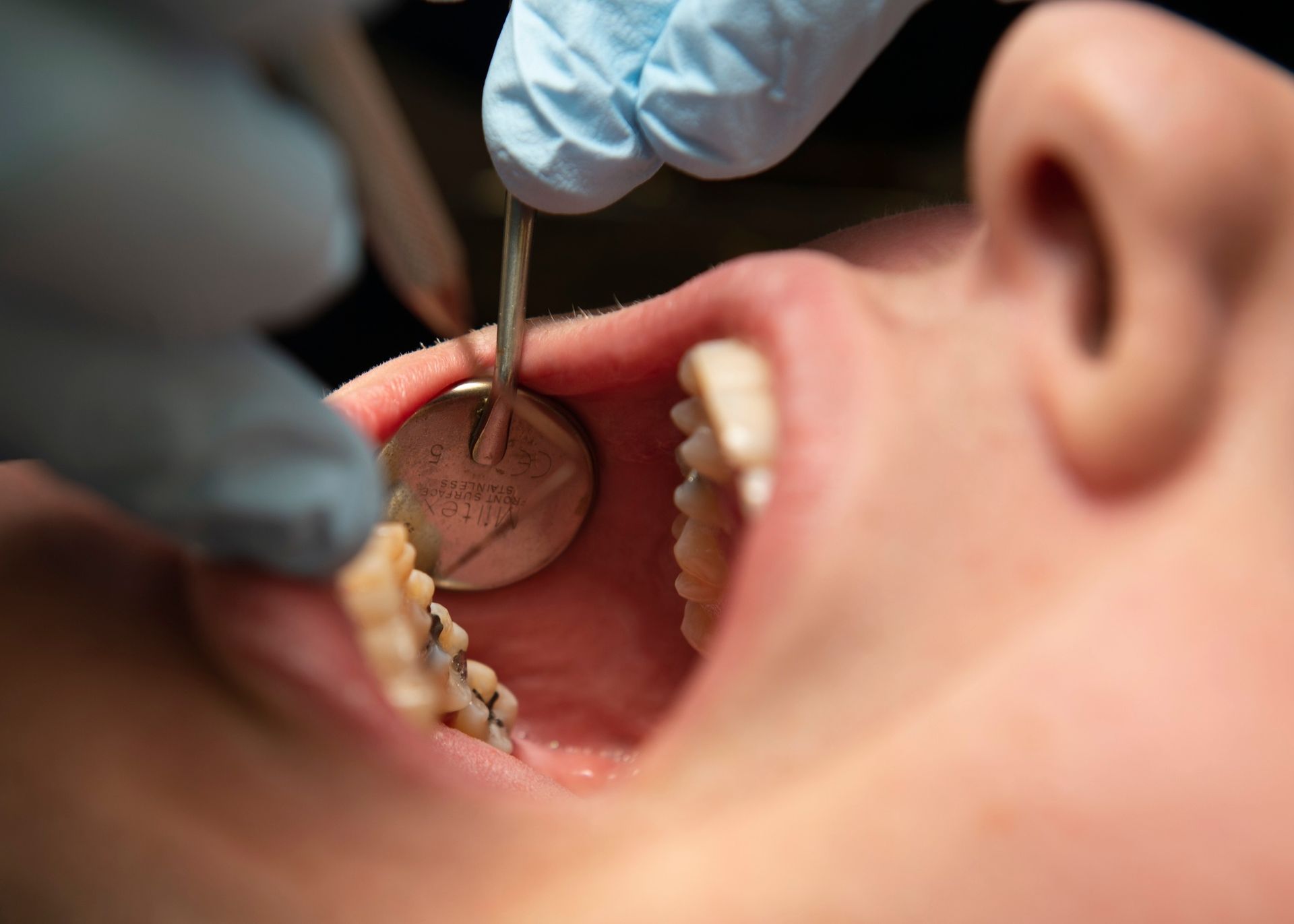 "Upokarzające". Dentystka zniszczyła jej zęby. Tyle przyznał sąd