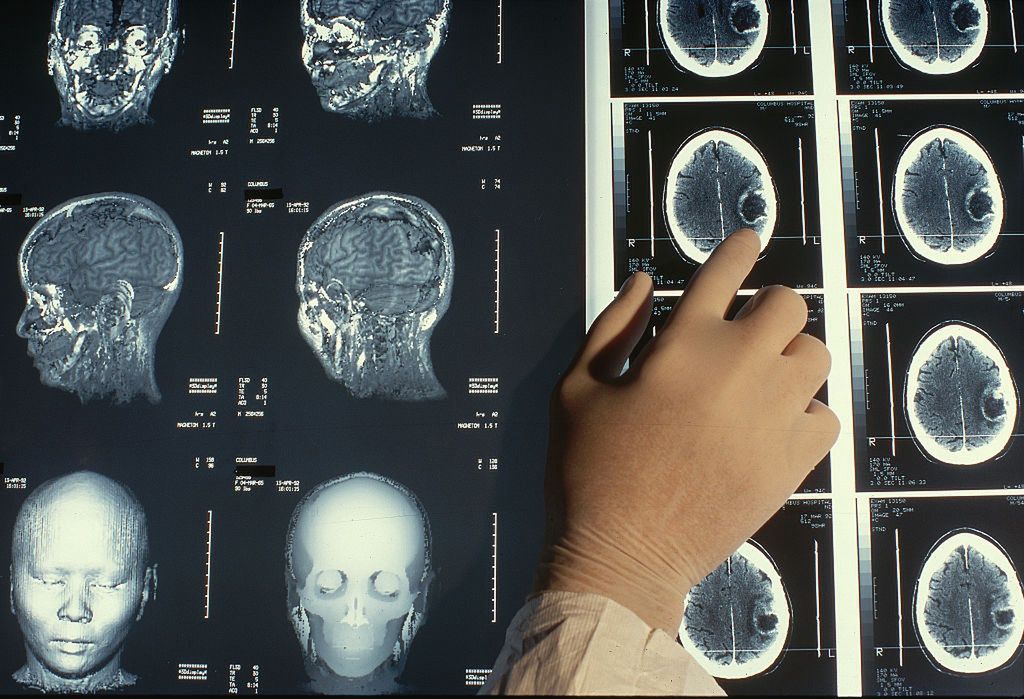 Polak opowiada: Ta metoda ma pomóc z rewolucyjną mapą mózgu