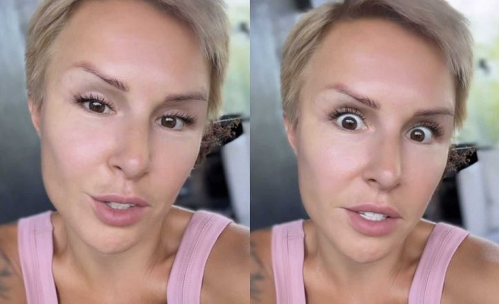 Blanka Lipińska skarży się na blizny po blefaroplastyce. Musiała ją poprawiać: "Mam uszkodzone dźwigacze powieki górnej"