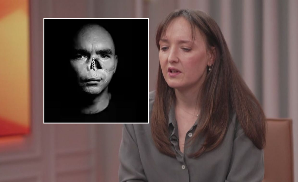 "Dzieci wybuchają płaczem". Ukrainiec stracił na wojnie twarz