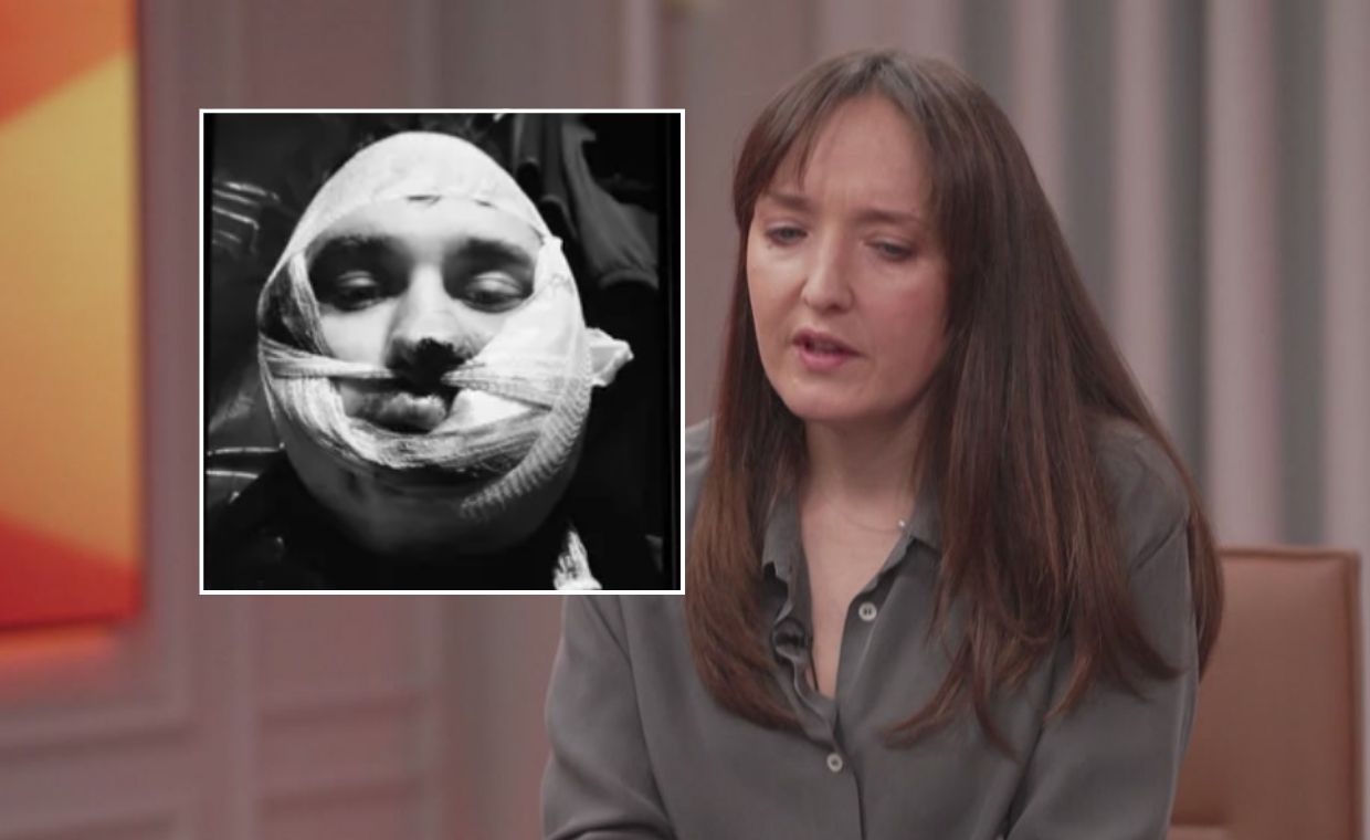 "Zobaczył w lustrze potwora". Wstrząsające relacje rannych Ukraińców