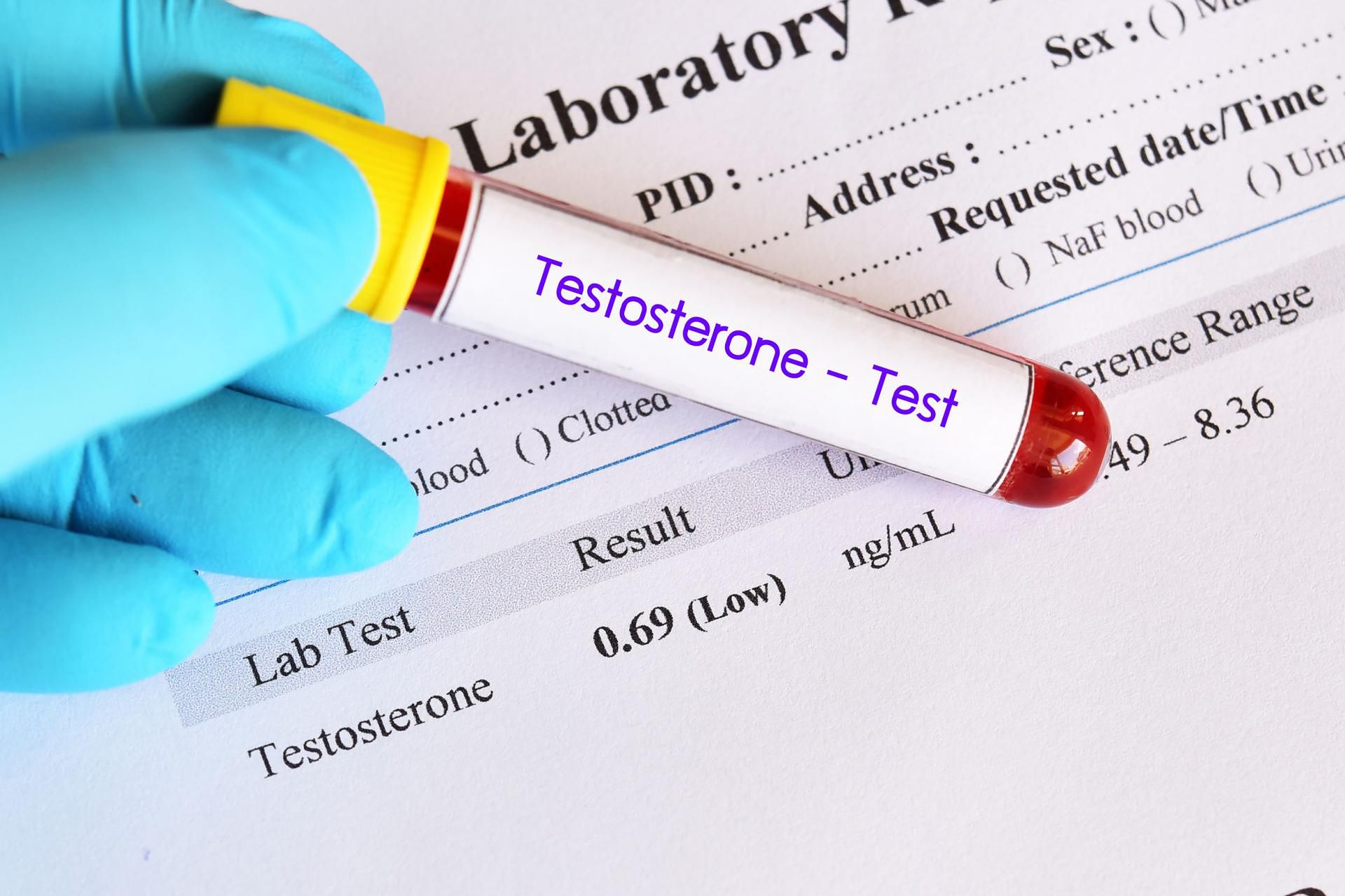 tabletki z testosteronem dla mężczyzn