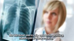 Ukraina walczy z epidemią gruźlicy. jak rozpoznać tę chorobę?