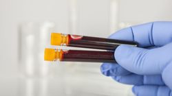 Biochemia krwi -  profile oznaczeń, normy