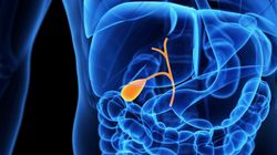 4 objawy raka woreczka żółciowego, które łatwo zbagatelizować (WIDEO)