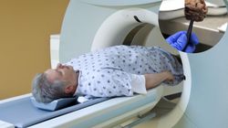 Każdy mężczyzna narażony jest na nowotwór prostaty. Wszystko zaczyna się po czterdziestce