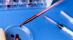 HCV przeciwciała - charakterystyka, wskazania, opis badania, wynik badania