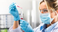 Kinaza kreatynowa (CPK) - wskazania do badania, interpretacja wyników