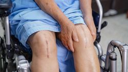 Dermatix - skład, działanie, wskazania, przeciwwskazania