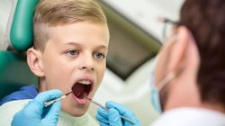 Brodawczak jamy ustnej - przyczyny, objawy i leczenie