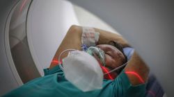 Tak COVID atakuje mózg. Widoczne zmiany zapalne