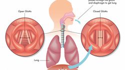 Nerw przeponowy - funkcje, budowa, najczęstsze choroby