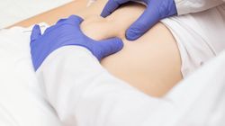 Objaw Blumberga - kiedy powstaje, co go wywołuje, fałszywie dodatni objaw Blumberga