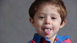 Obrzęk języka - najczęstsze przyczyny i leczenie