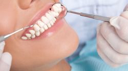 Założenie korony - rodzaje koron, wskazania i przebieg zabiegu