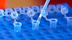 Cytomegalia - przyczyny, objawy, leczenie. Cytomegalia w ciąży