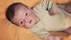 Zoja znaczy życie. Nie zwracaj uwagi na deformacje jej ciała i pomóż 